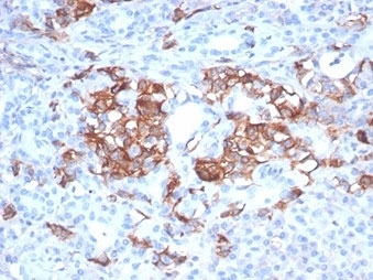 IHC staining of FFPE human pancreas tissue with MIC2 antibody (clone MIC2/7310). HIER: boil tissue sections in pH 9 10mM Tris with 1mM EDTA for 20 min and allow to cool before testing.~