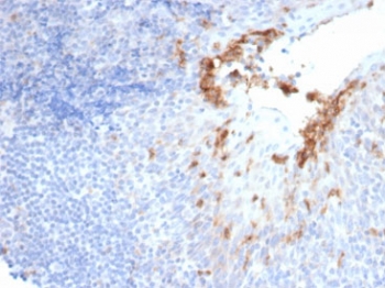 IHC staining of FFPE human prostate tissue with recombinant CD10 antibody (clone MME/6696R). HIER: boil tissue sections in pH 9 10mM Tris with 1mM EDTA for 20 min and allow to cool before testing.~