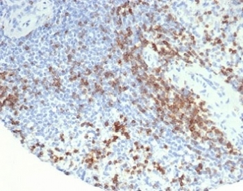 IHC staining of FFPE human spleen tissue with CD2 antibody (clone LFA2/7104). HIER: boil tissue sections in pH 9 10mM Tris with 1mM EDTA for 20 min and allow to cool before testing.~