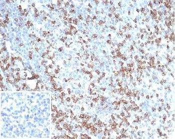 IHC staining of FFPE human tonsil tissue with CD2 antibo