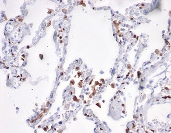 IHC staining of FFPE human lung tissue with S100A4 a