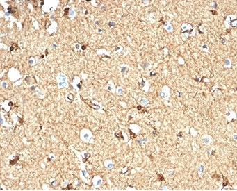 IHC staining of FFPE human brain tissue with CKB antibod