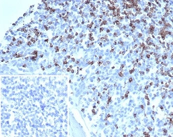 IHC staining of FFPE human tonsil tissue with LFA-2 ant