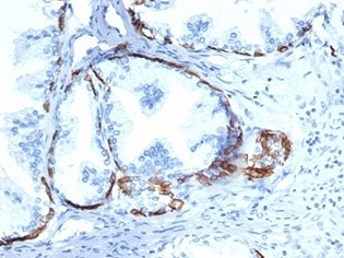 IHC staining of FFPE human prostate tissue with CK14 antibody (clone KRT14/6957). HIER: boil tissue sections in pH 9 10mM Tris with 1mM EDTA for 20 min and allow to cool before testing.~