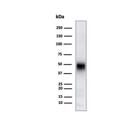 Western blot testing of human Jurkat cell lysate using CD2 antibody (clone LFA2/7106). Expected molecular weight ~47 kDa.~