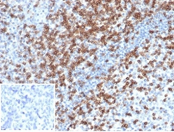 IHC staining of FFPE human tonsil tissue with CD2 antibody (clone LFA2/7106). Negative control inset: PBS used inste