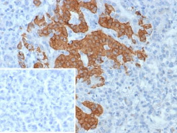 IHC staining of FFPE human pancreas tissue with GAD2 antibody (clone GAD2/8394R). Inset: PBS used in place of primary Ab (secondary Ab negative control). HIER: boil tissue sections in pH 9 10mM Tris with 1mM EDTA for 20 min and allow to cool before testing.~