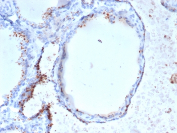 IHC staining of FFPE human thyroid tissue with GAD2 (GAD65) antibody (clone GAD2/6484). HIER: boil tissue sections in pH 9 10mM Tris with 1mM EDTA for 20 min and allow to cool before testing.~