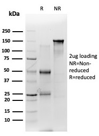 SDS-PAGE analysis of purified, BSA-free GAD2 (