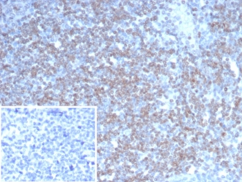 IHC staining of FFPE human tonsil tissue with NEUROG3