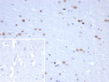 IHC staining of FFPE human brain tissue with NEUROG3 a