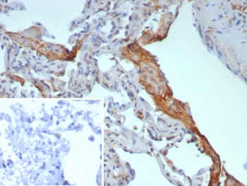 IHC staining of FFPE human lung tissue with Surfactant Protein D antibody (clone rSFTPD/8064). Inset: PBS used in place of primary Ab (secondary Ab negative control). HIER: boil tissue sections in pH 9 10mM Tris with 1mM EDTA for 20 min and allow to cool before testing.~