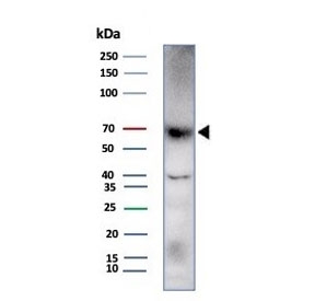 Western blot testing of human HDLM-2 cell lysate with Perforin-1 antibody (clone rPRF1/8058). Predicted molecular weight ~61 kDa.~