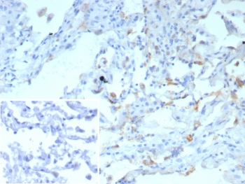 IHC staining of FFPE human lung tissue with Surfactant Protein D antibody (clone rSFTPD/8065). Inset: PBS used in place of primary Ab (secondary Ab negative control). HIER: boil tissue sections in pH 9 10mM Tris with 1mM EDTA for 20 min and allow to cool before testing.~