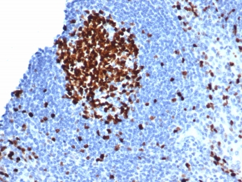 IHC staining of FFPE human tonsil tissue with Ki67 antibody (clone MKI67/6582). HIER: boil tissue sections in pH 9 10mM Tris with 1mM EDTA for 20 min and allow to cool before testing.~