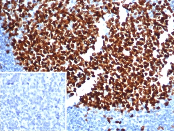 IHC staining of FFPE human tonsil tissue with Ki67 ant