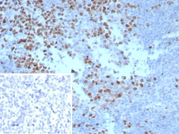IHC staining of FFPE human tonsil tissue with Ki67 antibody (clone MKI67/8743). Inset: PBS used in place of primary Ab (secondary Ab negative control). HIER: boil tissue sections in pH 9 10mM Tris with 1mM EDTA for 20 min and allow to cool before testing.~