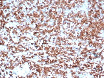IHC staining of FFPE human tonsil tissue with CD39 antibody (clone CD39/6860). HIER: boil tissue sections in pH 9 10mM Tris with 1mM EDTA for 20 min and allow to cool before testing.~