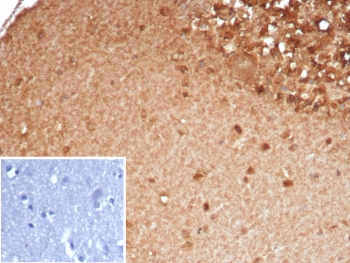 IHC staining of FFPE human brain tissue with SLC18A2 antibody (clone SLC18A2/7983). Inset: PBS used in place of primary Ab (secondary Ab negative control). HIER: boil tissue sections in pH 9 10mM Tris with 1mM EDTA for 20 min and allow to cool before testing.~