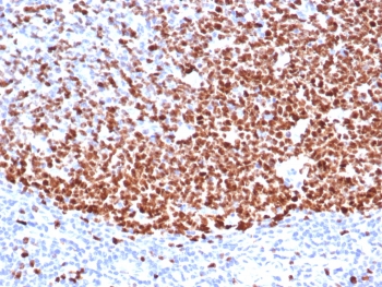 IHC staining of FFPE human tonsil tissue with Ki67 antibody (clone MKI67/6571). HIER: boil tissue sections in pH 9 10mM Tris with 1mM EDTA for 20 min and allow to cool before testing.~