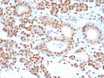 IHC staining of FFPE human salivary gland tissue with MGMT antibody (clone MGMT/7454). HIER: boil tissue sections in pH 9 10mM Tris with 1mM EDTA for 20 min and allow to cool before testing.~