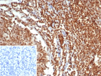 IHC staining of FFPE human testis tissue with M