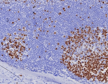 IHC staining of FFPE human tonsil tissue with Ki67