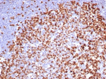 IHC staining of FFPE human tonsil. Ki67 antibody (clone MKI67/8315R). HIER: boil tissue sections in pH 9 10mM Tris with 1mM EDTA for 20 min and allow to cool before testing.~