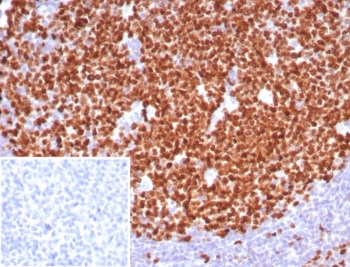 IHC staining of FFPE human tonsil tissue with Ki67 antibody (clo