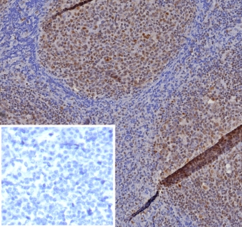IHC staining of FFPE human tonsil tissue with MGMT a