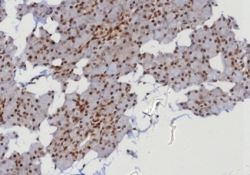 IHC staining of FFPE human parotid gland with MGMT antibody (clone MGMT/8128R). HIER: boil tissue sections in pH 9 10mM Tris with 1mM EDTA for 20 min and allow to cool before testing.~