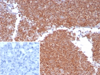 IHC staining of FFPE human lymph node tissue with