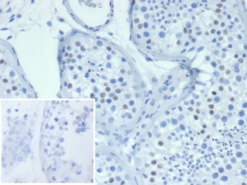 IHC staining of FFPE human testis tissue with Wilms Tumor antibody (clone WT1/7450). Inset: PBS used in place of primary Ab (secondary Ab negative control). HIER: boil tissue sections in pH 9 10mM Tris with 1mM EDTA for 20 min and allow to cool before testing.~