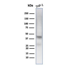 Western blot testing of human THP-1 cell lysate with Wilms Tumor 1 antibody (clone WT1/7451). Expected molecular weight 47-55 kDa.~