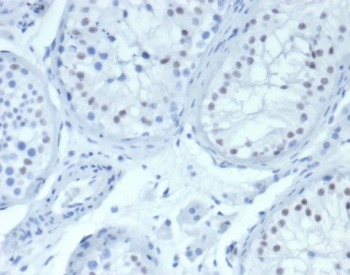 IHC staining of FFPE human testis tissue with Wilm's Tumor antibody (clone WT1/7452). HIER: boil tissue sections in pH 9 10mM Tris with 1mM EDTA for 20 min and allow to cool before testing.~