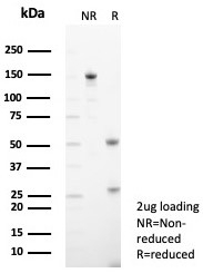 SDS-PAGE analysis of purified, BSA-free TPH1 antibody (