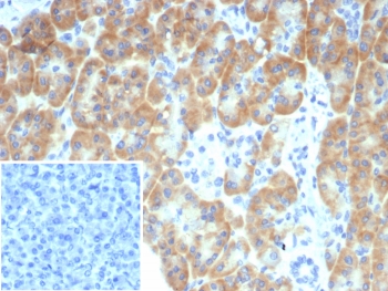IHC staining of FFPE human pancreas tissue with TRPC6 antibody (clone TRPC6/7671). Inset: PBS used in place of primary Ab (secondary Ab negative control). HIER: boil tissue sections in pH 9 10mM Tris with 1mM EDTA for 20 min and allow to cool before testing.~