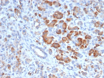 IHC staining of FFPE human pancreas tissue with TRPC6 antibody (clone TRPC6/7672). HIER: boil tissue sections in pH 9 10mM Tris with 1mM EDTA for 20 min and allow to cool before testing.~