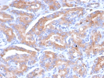 IHC staining of FFPE human prostate tissue with SI-CLP antibody (clone CHID1/6368) HIER: boil tissue sections in pH 9 10mM Tris with 1mM EDTA for 20 min and allow to cool before testing.~