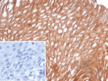 IHC staining of FFPE human esophagus tissue with SI