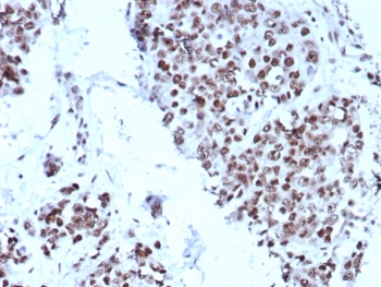 IHC staining of FFPE human bladder tissue with p5