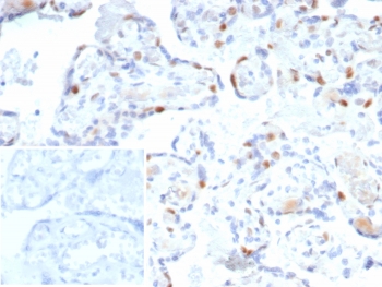 IHC staining of FFPE human bladder tissue with p57Kip2 antibody. Strong nuclear staining using rKIP2/7238 mAb at 2ug/ml. Inset: PBS used in place of primary Ab (secondary Ab negative control). HIER: boil tissue sections in pH 9 10mM Tris with 1mM EDTA for 20 min and allow to cool before testing.