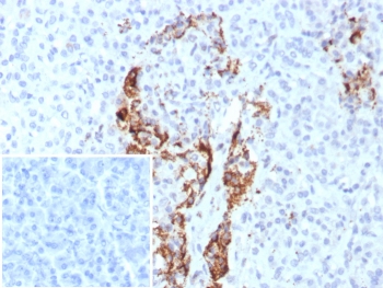 IHC staining of FFPE human pancreas tissue with Insulin antibody (clone rIRDN/8546). Inset: PBS used in place of primary Ab (secondary Ab negative control). HIER: boil tissue sections in pH 9 10mM Tris with 1mM EDTA for 20 min and allow to cool before testing.~