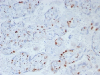IHC staining of FFPE human placenta. Strong nuclear staining using KIP2/8169R at 2ug/ml. HIER: boil tissue sections in pH 9 10mM Tris with 1mM EDTA for 20 min and allow to cool before testing.~