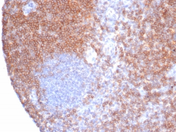 IHC staining of FFPE human tonsil tissue with CD6 antibody (clone rC6/372). HIER: boil tissue sections in pH 9 10mM Tris with 1mM EDTA for 20 min and allow to cool before testing.~