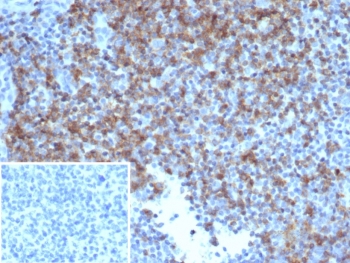 IHC staining of FFPE human tonsil tissue with CD6 antibody