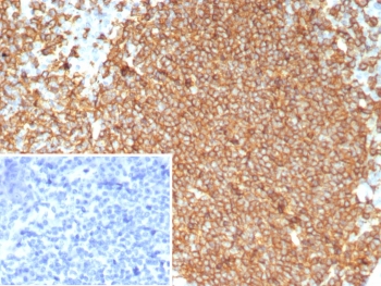 IHC staining of FFPE human tonsil tissue with recombinant CD20 antibody (clone MS4A1/8072R). Inset: PBS used in place of primary Ab (secondary Ab negative control). HIER: boil tissue sections in pH 9 10mM Tris with 1mM EDTA for 20 min and allow to cool before testing.~