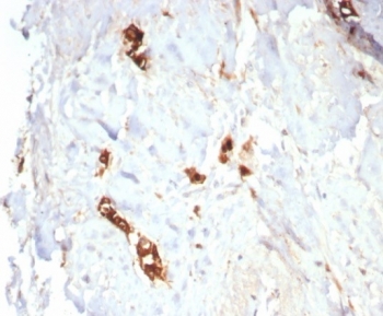 IHC staining of FFPE human lactating breast tissue with Mammaglobin antibody (clone MGB/7980R). HIER: boil tissue sections in pH 9 10mM Tris with 1mM EDTA for 20 min and allow to cool before testing.~