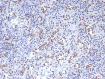 IHC staining of FFPE human spleen stained Cyclin D1 antibody (clone CCND1/7868). HIER: boil tissue sections in pH 9 10mM Tris with 1mM EDTA for 20 min and allow to cool before testing.~
