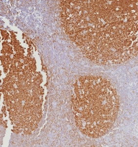 IHC staining of FFPE human tonsil tissue with BOB1 antibody (clone BOB1/7467). HIER: boil tissue sections in pH 9 10mM Tris with 1mM EDTA for 20 min and allow to cool before testing.~
